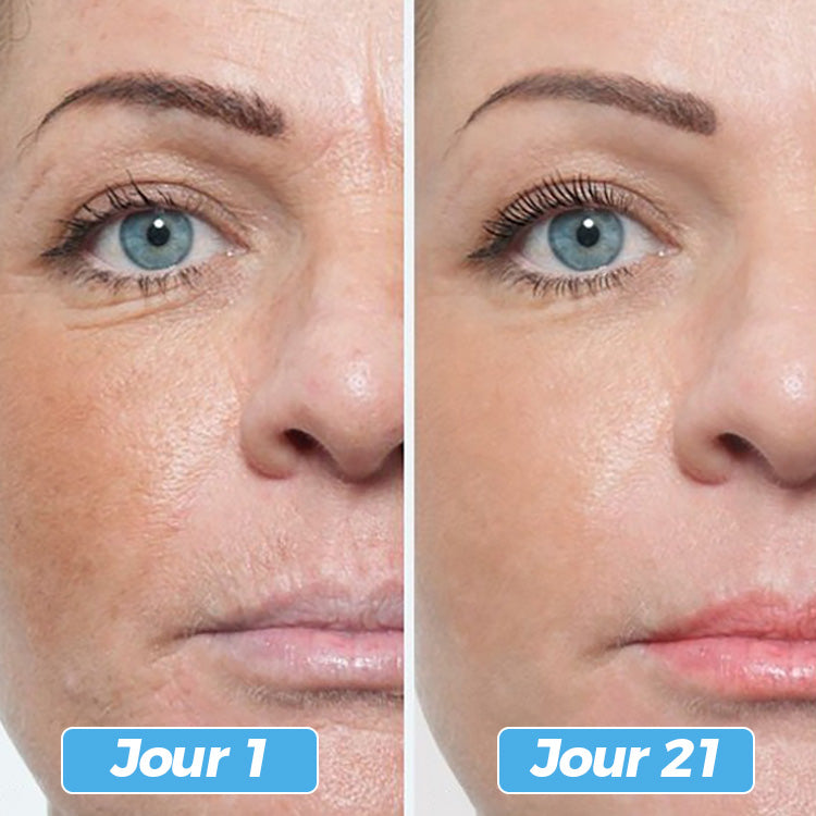 Glowskin Pro2 - Masque LED Soin Visage & Cou